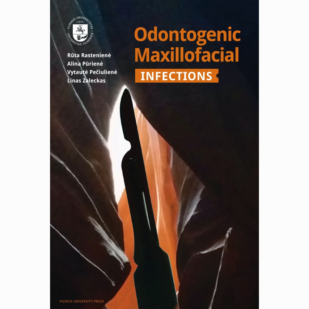 Odontogenic Maxillofacial Infections