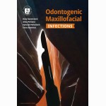 Odontogenic Maxillofacial Infections