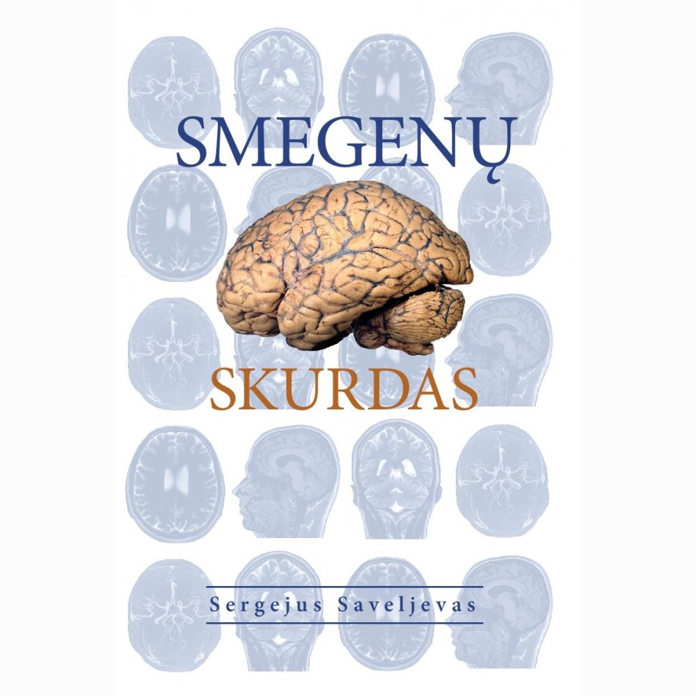 Smegenų skurdas